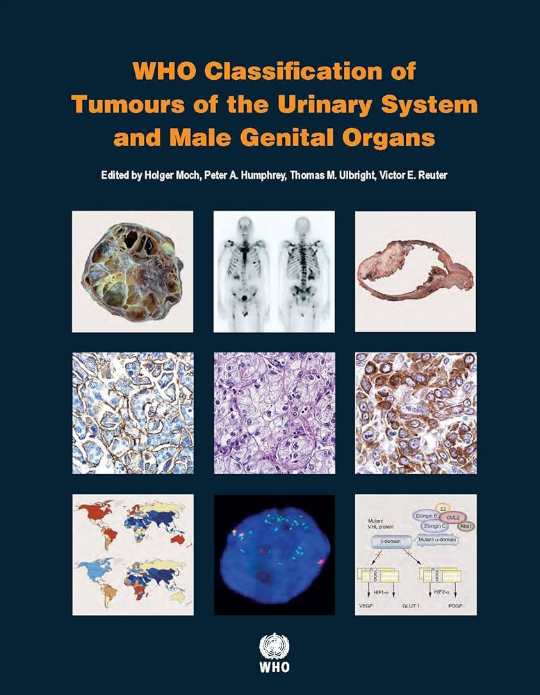 WHO Classification of Tumours of the Urinary System and Male